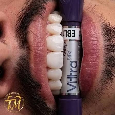 Odontologia Thales Monteiro