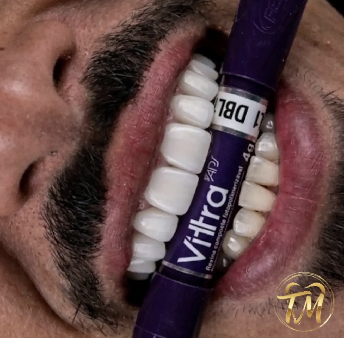 Odontologia Thales Monteiro